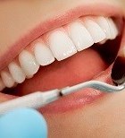כל מה שרציתם לדעת על השתלות שיניים ביום אחד-תמונה